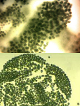 Microcystis (간독소 배출)